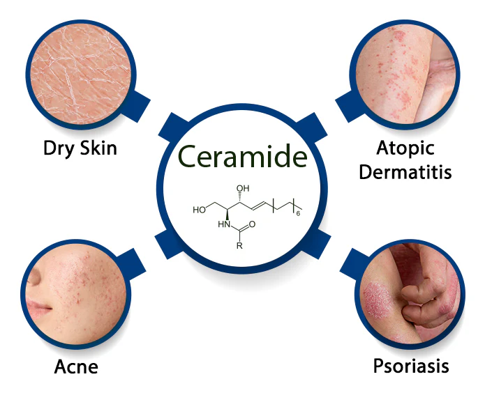 ceramides